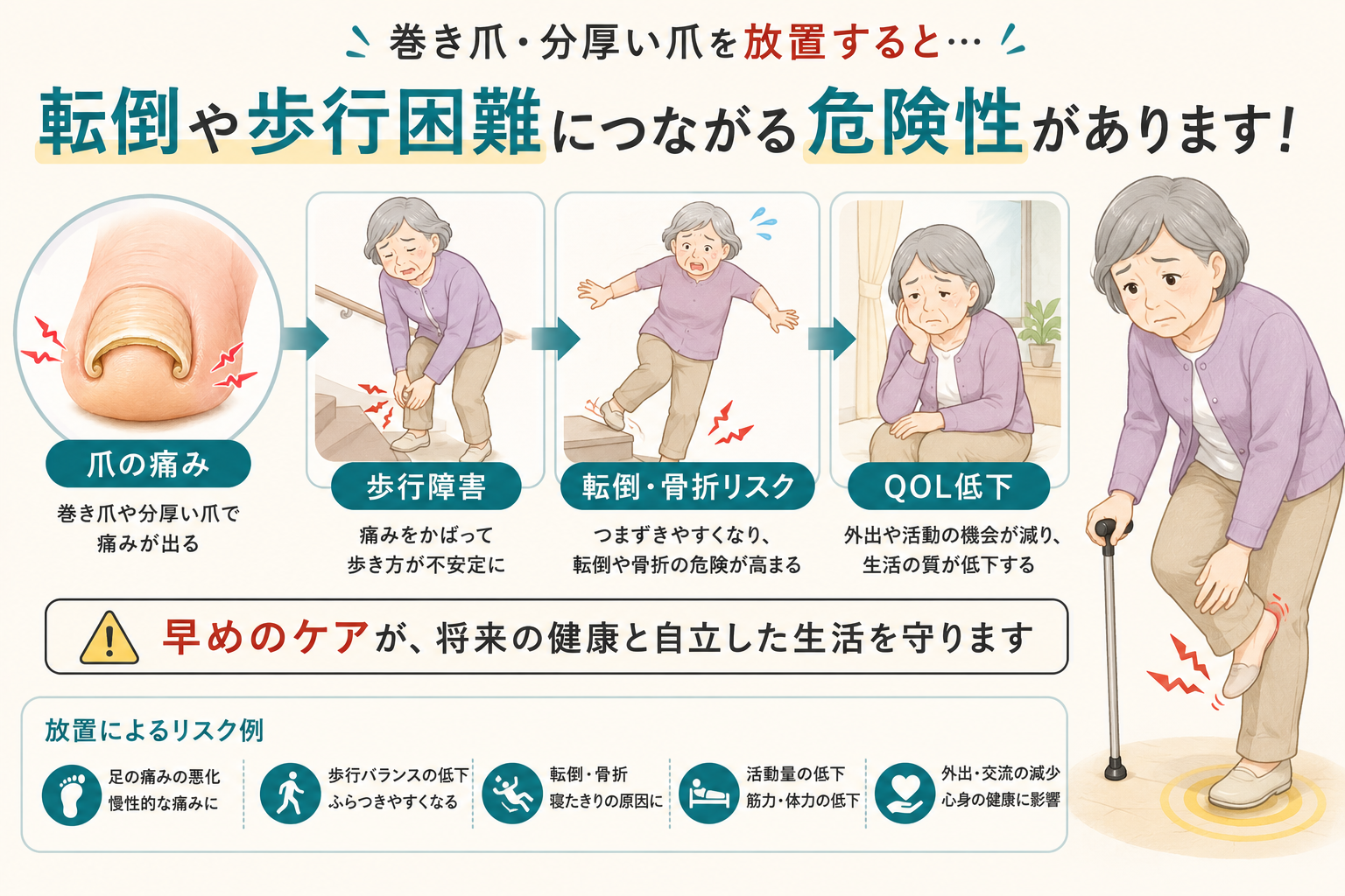 高齢者の巻き爪放置による歩行困難や転倒リスクの注意イメージ