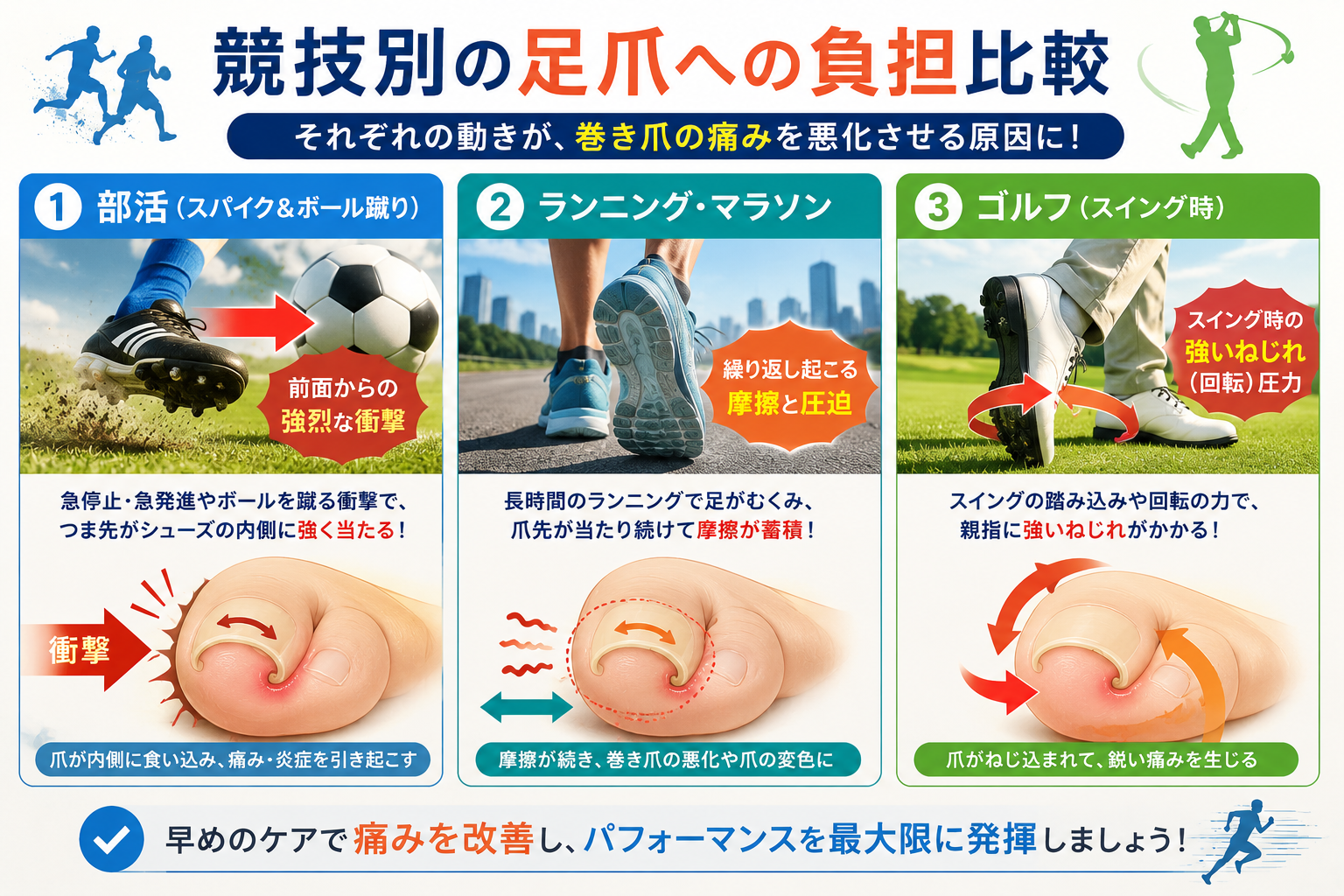部活・ランニング・ゴルフにおける足の爪への負担と痛みの違い