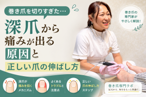 【巻き爪を切りすぎた…】深爪から痛みが出る原因と正しい爪の伸ばし方｜巻き爪専門ラボ