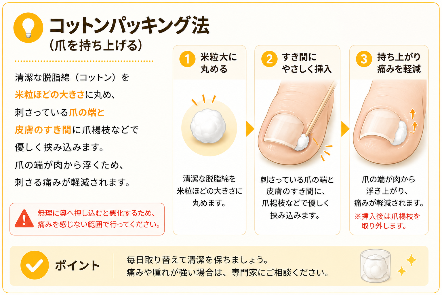 コットンパッキング法の手順（1.米粒大に丸める 2.すき間にやさしく挿入 3.持ち上がり痛みを軽減）