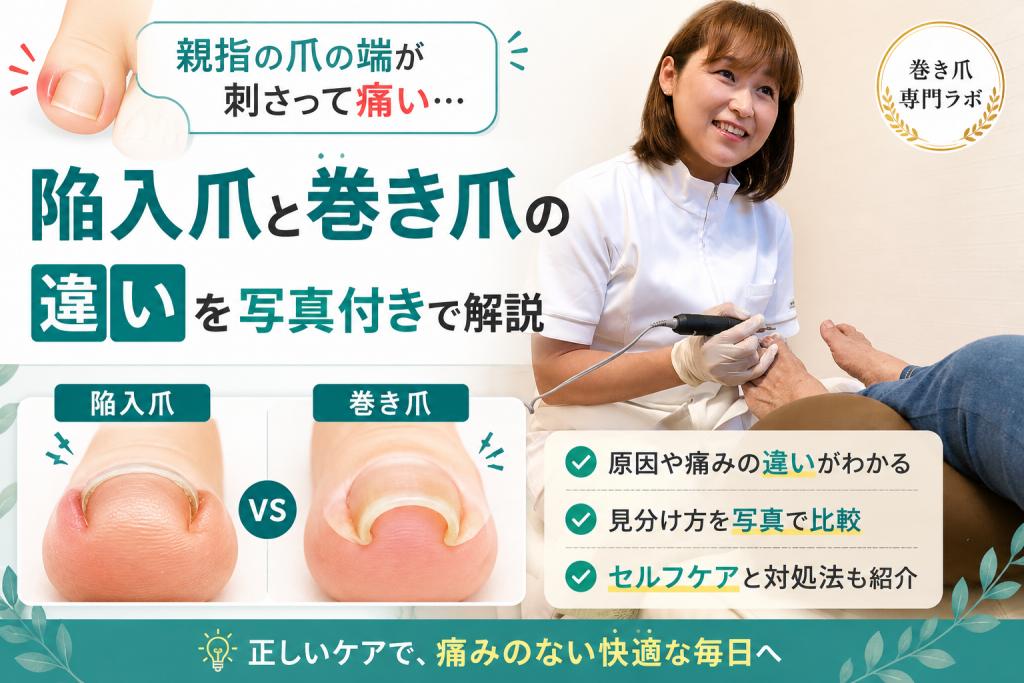 【親指の爪の端が刺さって痛い】陥入爪と巻き爪の違いを写真付きで解説｜巻き爪専門ラボ