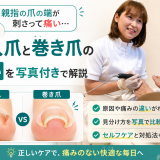 【親指の爪の端が刺さって痛い】陥入爪と巻き爪の違いを写真付きで解説｜巻き爪専門ラボ