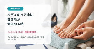ペディキュアやジェルネイル中に巻き爪が気になる時の確認ポイント｜巻き爪専門ラボ